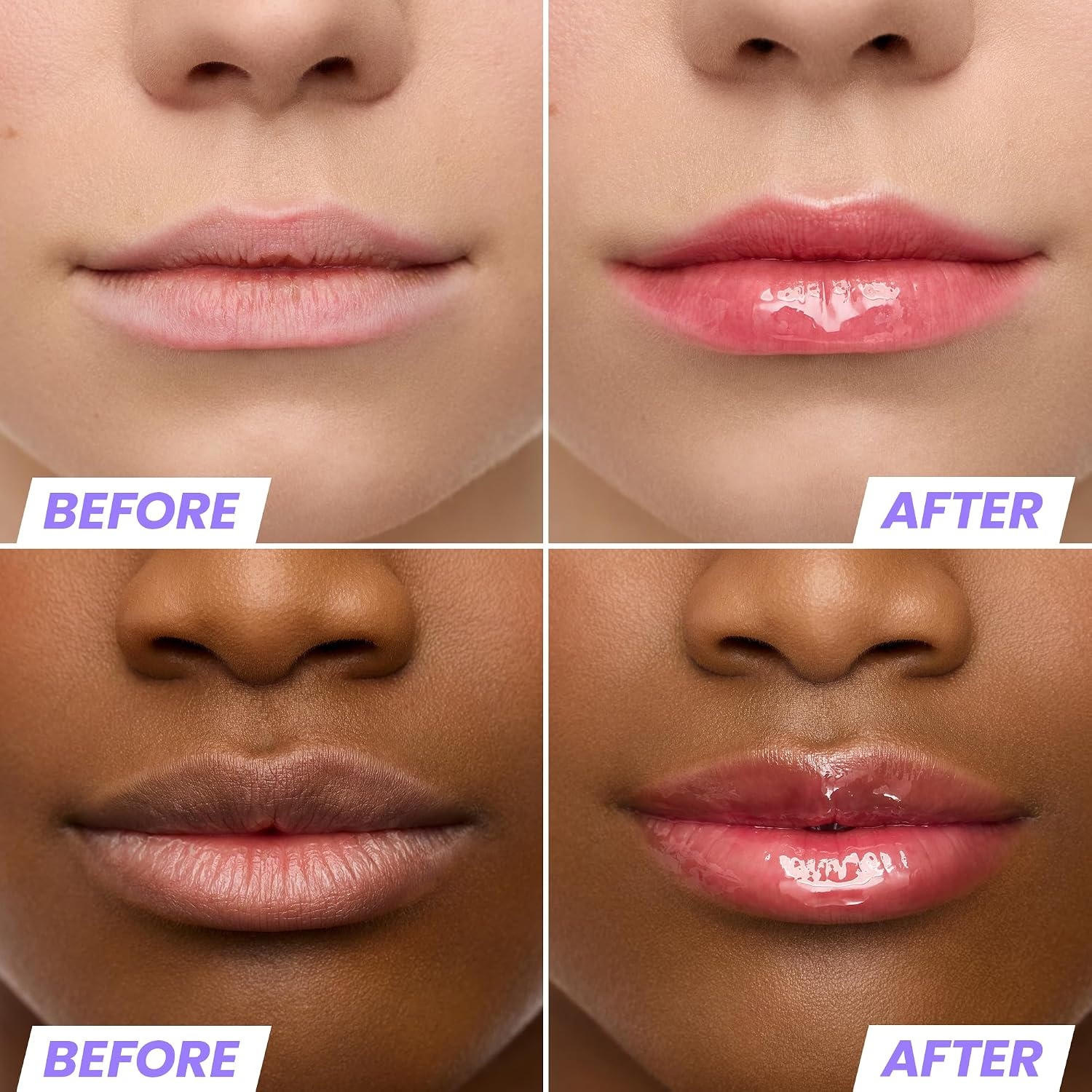 image:imageWonderskin Lip Oil Rehab Serum Tinted Lip Oil Hydrating Lip SerumAmour