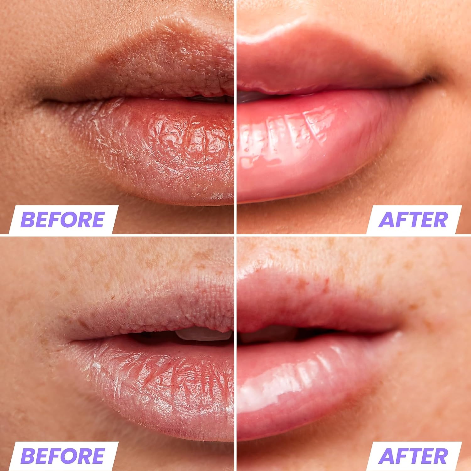 image:imageWonderskin Lip Oil Rehab Serum Tinted Lip Oil Hydrating Lip SerumClear