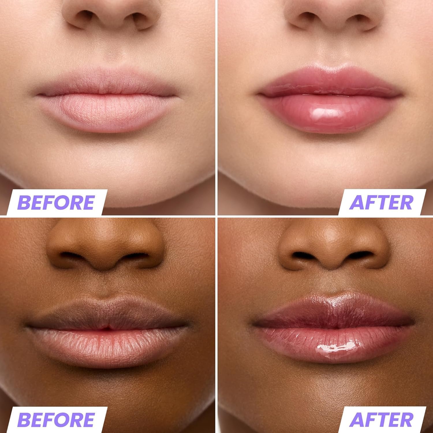 image:imageWonderskin Lip Oil Rehab Serum Tinted Lip Oil Hydrating Lip SerumHoney