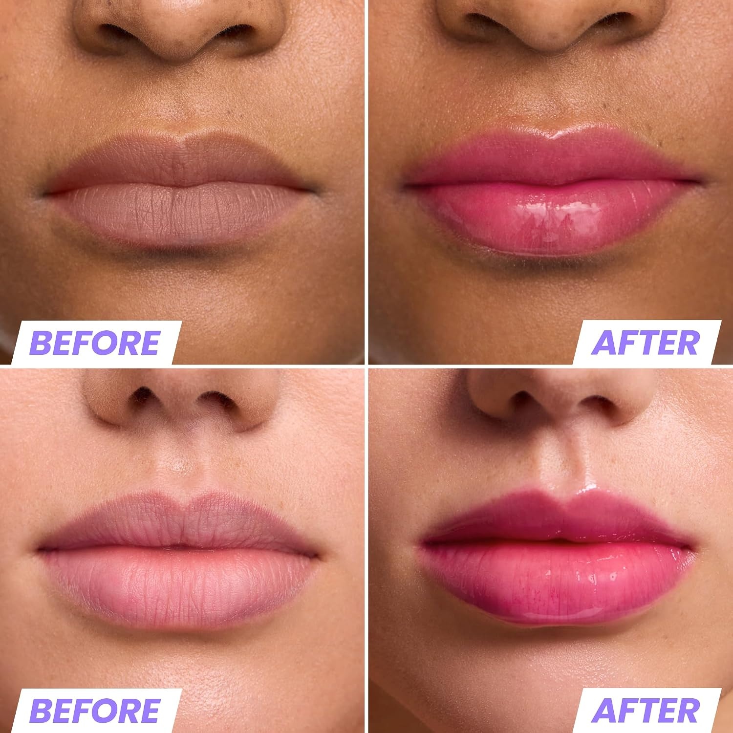 image:imageWonderskin Lip Oil Rehab Serum Tinted Lip Oil Hydrating Lip SerumKissed
