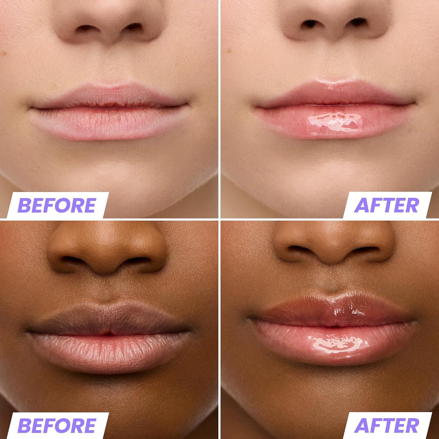 image:imageWonderskin Lip Oil Rehab Serum Tinted Lip Oil Hydrating Lip SerumLover
